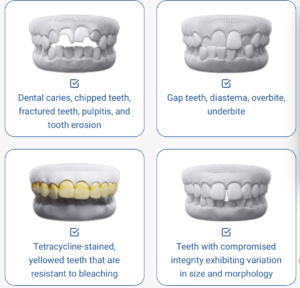 What is porcelain Crown restoration? Is it beneficial