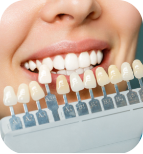 What are veneers? Is it a good option?