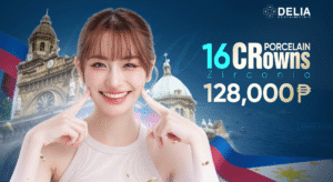 Advantages of Getting Porcelain Crowns/Veneers in the Philippines